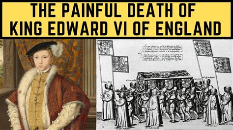 how did king edward die.